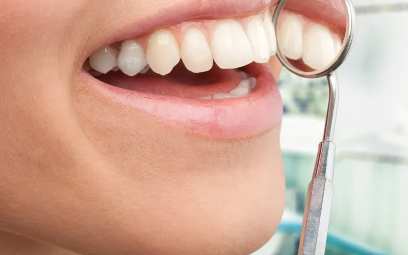 Precautions After Dental Crown Treatment