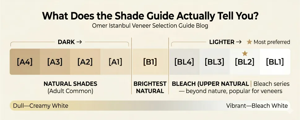 How Should Veneer Color Be Chosen?